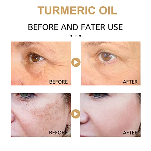 2pack Turmeric dark spot Corrector Serum, prirodni Turmeric Repair Serum za lice za Melazmu lica, hidrirajte dosadnu i suhu kožu